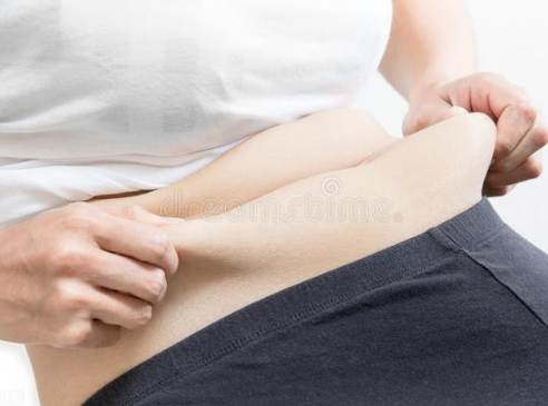 养生知识：祛湿一定要拔罐艾灸吗？