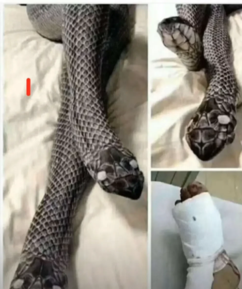 女子买蛇状丝袜吓坏老公导致受伤