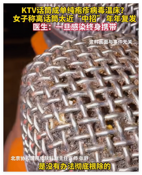 KTV话筒暗藏健康隐患：专家提醒警惕疱疹病毒传播